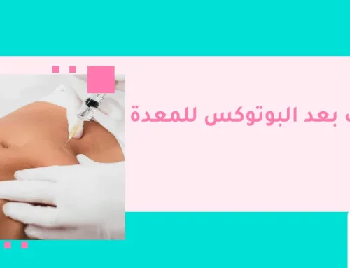  أهم 5 تعليمات بعد البوتوكس للمعدة