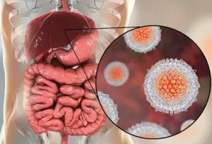 أغلب حالات التهاب الكبد ناجمة عن عدوى فيروسية بالأساس